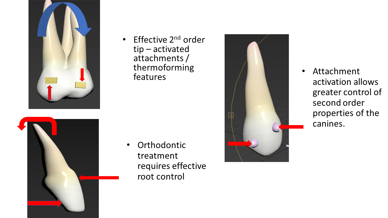 WhitesmileClear deep bite control and open bite control