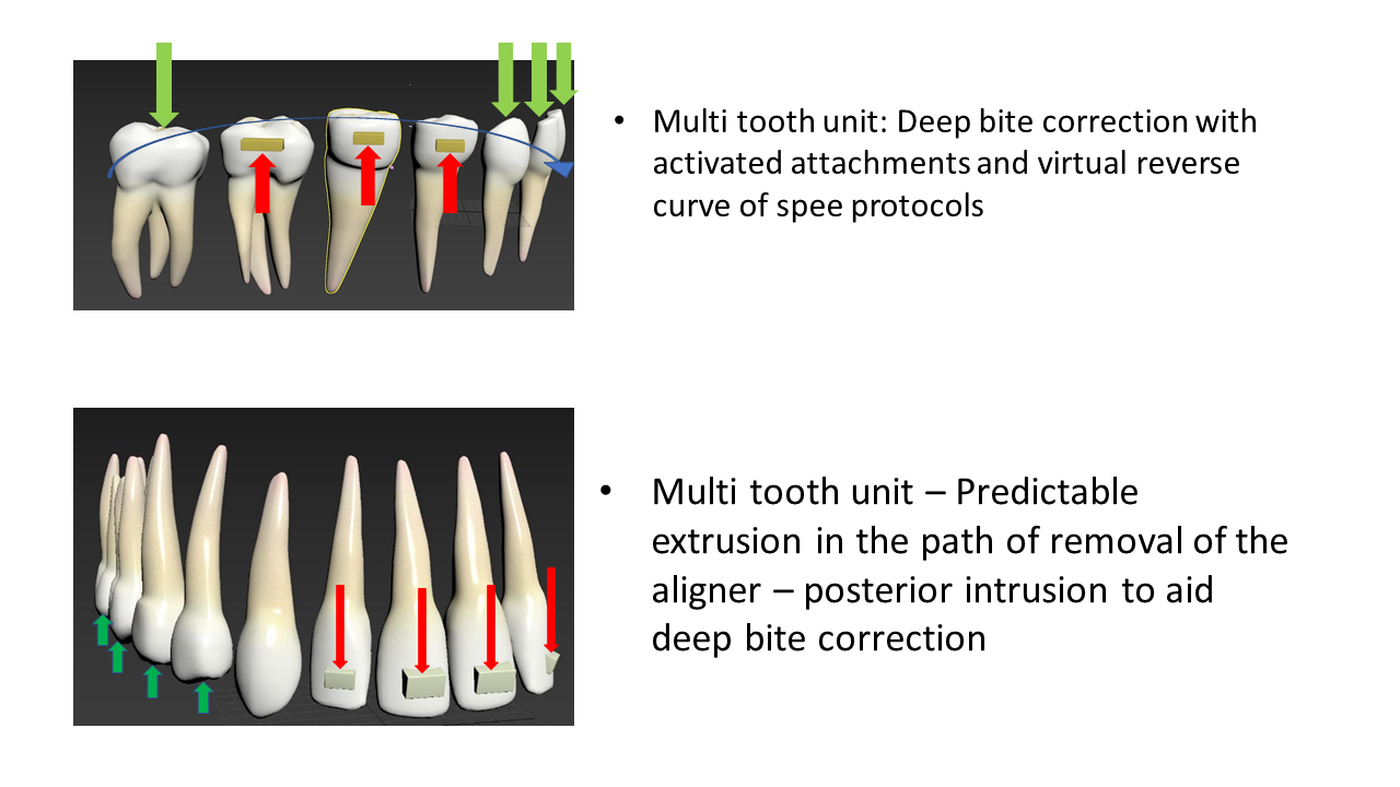 WhitesmileClear deep bite control and open bite control